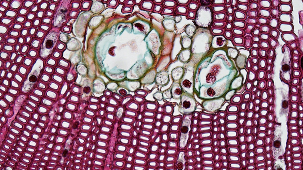 Cells. An example of a cell